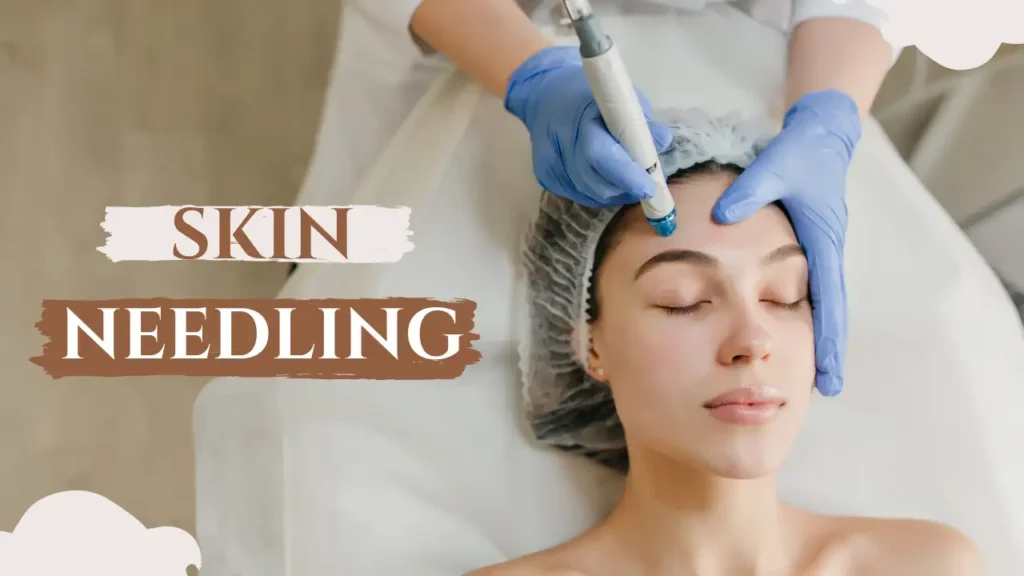 skin needling in dublin